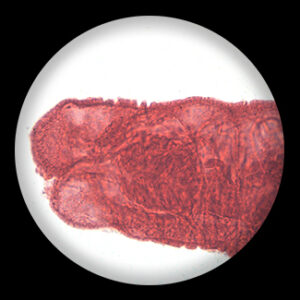 Tapeworm Larva