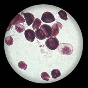 Taenia Solium Cycticerus w.m.