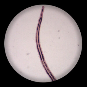 Schistosomal Female w.m.