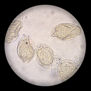 Schistosomal Egg