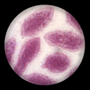 Schistosomal Japonicum Sporaysts w.m.