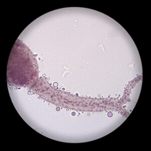 Schistosomal Japonicum Cercaria w.m.