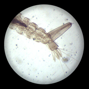 Mosquito Larva w.m.