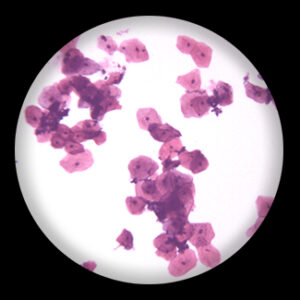 Squamous Epithelial from Human Mouth Scrapings