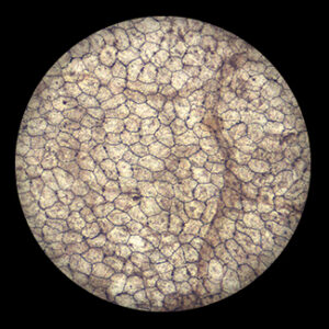 Single Ply Squamous w.m.