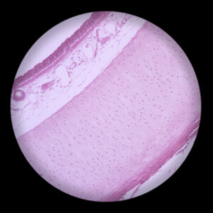 Transparent Cartilage