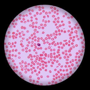 Human Blood Smear