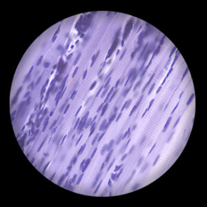 Skeletal muscle l.s., c.s.