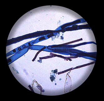 BS0203