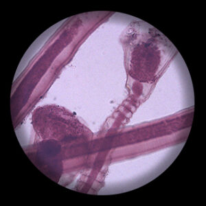 สไลด์ถาวร โปโตซัว โอบีเลีย