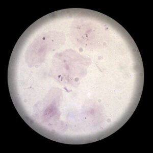 สไลด์ถาวร เซลล์เยื่อบุข้างแก้ม