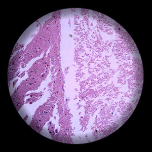 สไลด์ถาวร เซลล์ประสาท