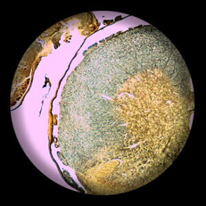 สไลด์ถาวร เซลล์ประสาทไขสันหลัง