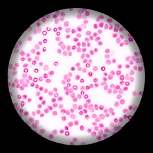 สไลด์ถาวร เซลล์เม็ดเลือดคน