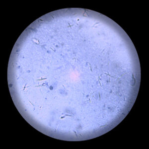 สไลด์ถาวร เซลล์อสุจิคน