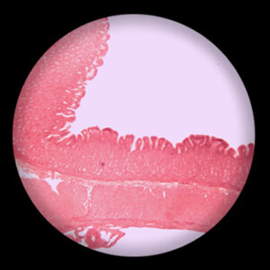 Stomach Paries sec.