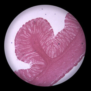 Large Intestine sec.