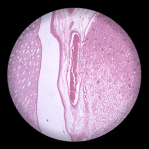 Reins Pancreatic sec.