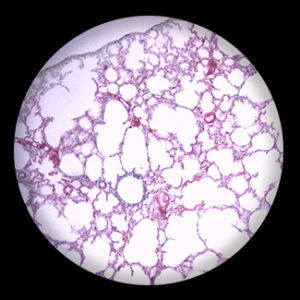 Lung Vascular Injection sec.