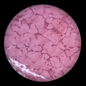 Vein Mammal