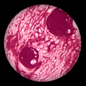 Kidney Vascular Injection sec.