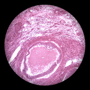 Ovary sec.