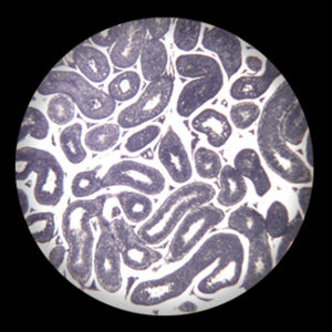 Sperm Smear