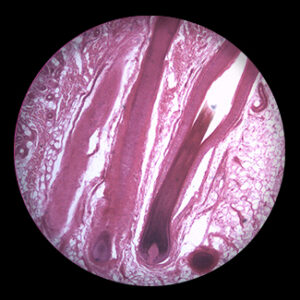 Human Hair Follicle