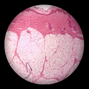 Human Sweat Glands sec.