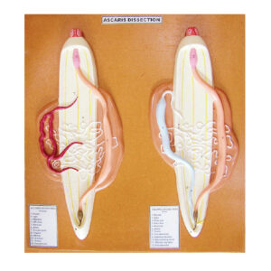 แบบจำลองพยาธิไส้เดือนตัวกลมใน ลำไส้เล็ก