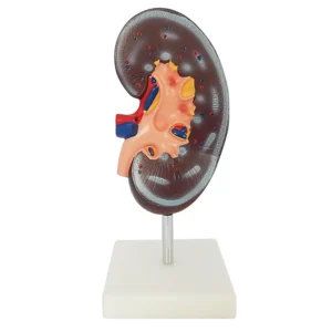 Human Kidney Model