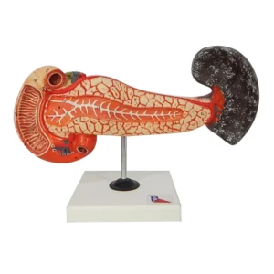 Pancreas, Duodenum, Spleen Model