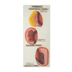 Tonsils