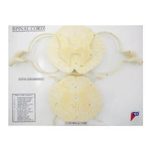 หุ่นจำลองกระดูกไขสันหลัง  (Vertebral and Partial Spinal Cord Model)