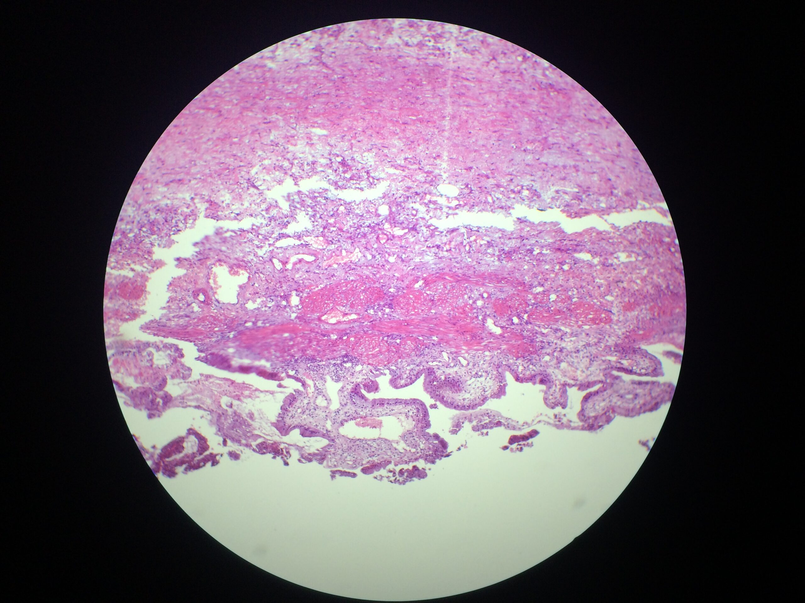 ชุดสไลด์ถาวรเชื้อโรคและความผิดปกติในระบบทางเดินอาหาร