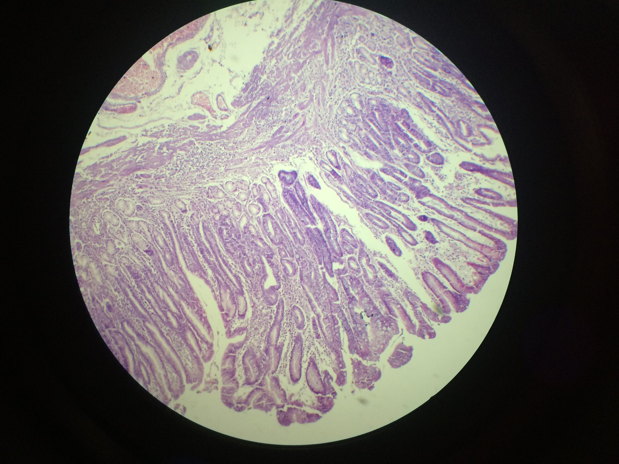 ชุดสไลด์ถาวรเชื้อโรคและความผิดปกติในระบบทางเดินอาหาร
