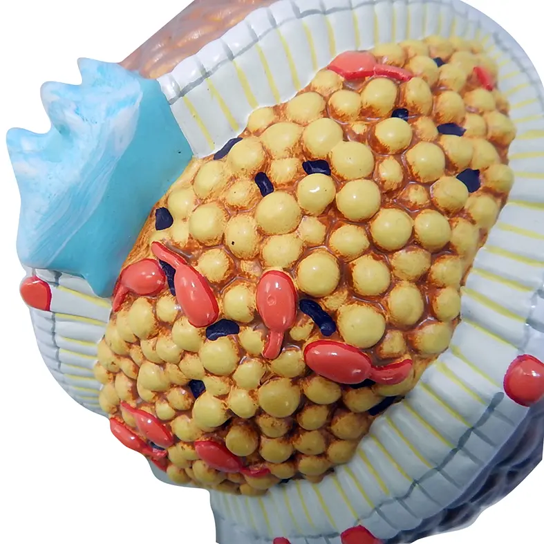หุ่นจำลองคอเลสเตอรอล