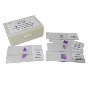 ชุดสไลด์ถาวรเชื้อโรคและความผิดปกติในระบบน้ำเหลืองและเลือด