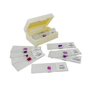 ชุดสไลด์ถาวรเชื้อโรคและความผิดปกติในระบบขับถ่ายของเสีย